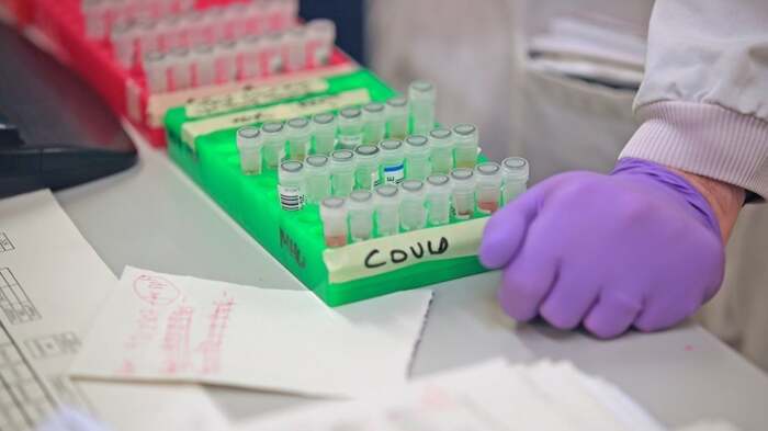 Αυτά είναι τα κρούσματα του κορωνοϊού στο Δήμο Ελασσόνας